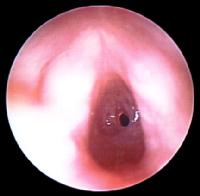 993855-995328-1193tn